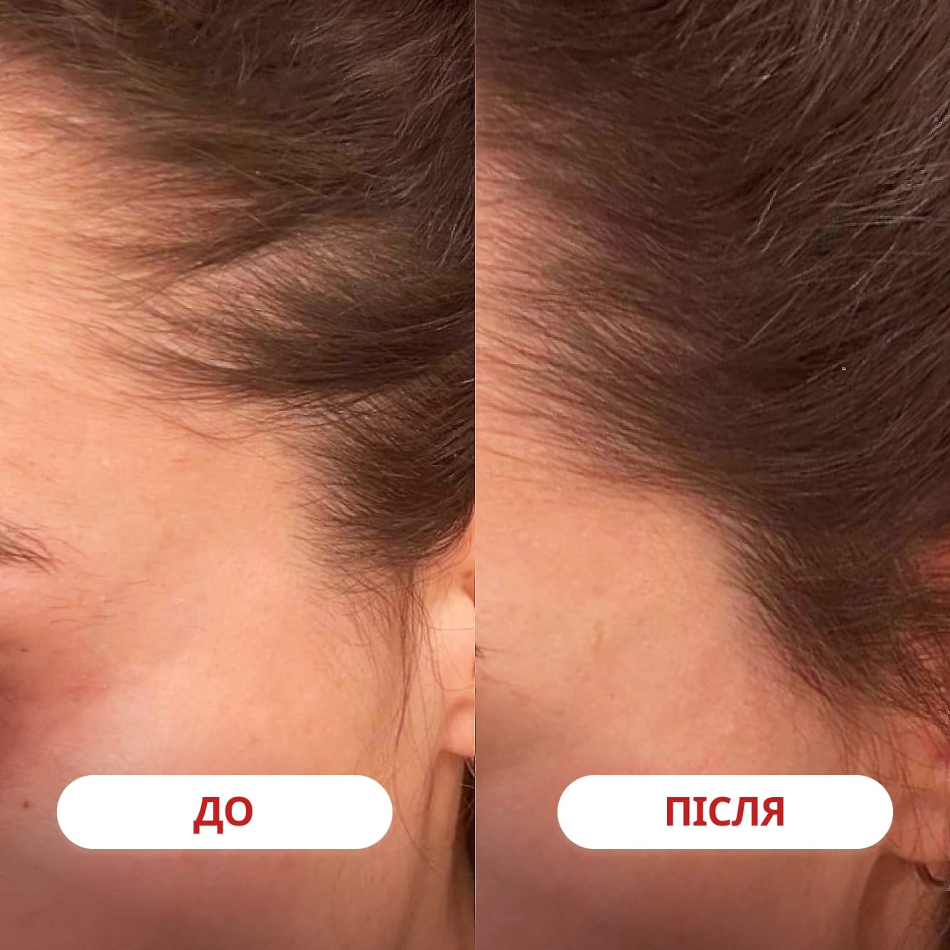 A-Biotin - preview 5